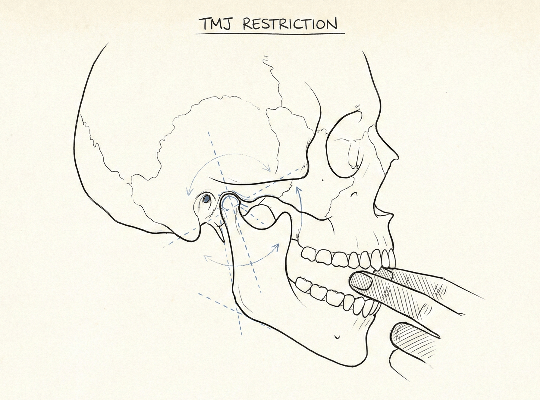 The "3-Finger" Test: Is Your Jaw Locking You Out of Deep Sleep? - Nevafet