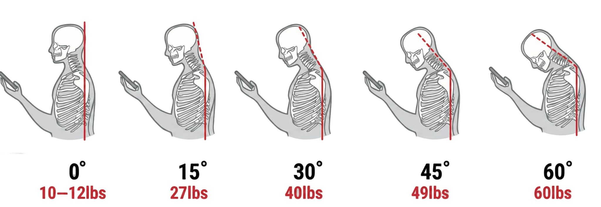 The Cervical Cloud - Nevafet